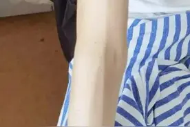 为了瘦，她们仿佛“着了魔”！从100斤减到60斤后，两位杭州花季少女依旧没停下来……图片