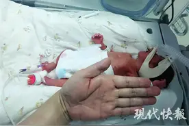 两个多月呵护，“巴掌大”早产儿终于可以回家了图片
