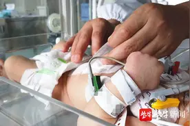 新生儿肚脐“冒泡泡”，这是患上了一种病图片