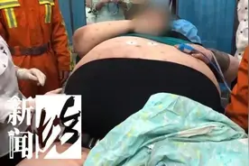 20年没下楼的500斤小胖在六院拔管了！三个月全程护航重症团队发出强烈呼吁图片
