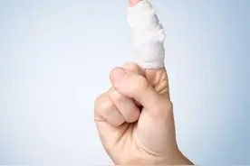 受伤2个月的食指终于健全！3D全形手指再造术助患者恢复自信图片