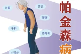 走走停停小碎步，颤颤巍巍面具脸，“帕金森”究竟什么样？图片