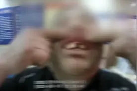 酒后醒来门牙丢了？男子报警称被人打 结果很尴尬图片