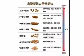 大便，是我们健康的晴雨表图片