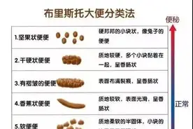 大便，是我们健康的晴雨表图片