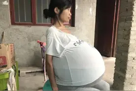 2年时间女子肚子疯长成巨球，每晚只能坐着睡觉……10岁儿子撑起家图片