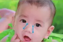 腺样体切除后宝宝身体“虚上加虚”，教你3招调养回来图片