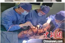 男孩两腿“落差”10厘米上海得矫治 专家：3个月可“拉平”10个月可自由奔跑图片