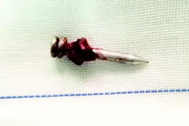 惊险！炮钉枪“走火”女子遭穿喉图片