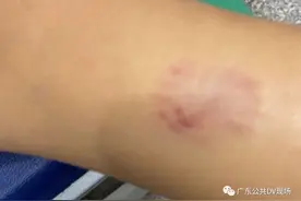 女童逗狗被咬伤，达成和解后狗竟被摔死！警方介入图片