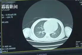 2岁女童喝现挤羊奶患上“布氏杆菌病”！专家：这个误区要警惕图片