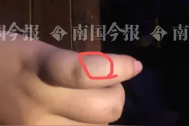 9月6日焦点图：柳州一女子餐馆吃饭时 天花板掉下活老鼠还抓伤人图片