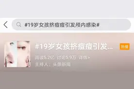 “青春痘”惹祸！19岁女孩因挤痘引发颅内感染，“危险三角区”别乱碰图片