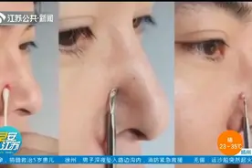 19岁女孩挤痘痘引发颅内感染，面部“危险三角区”请注意！视频封面