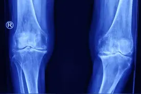 兰大二院骨科三病区成功实施罕见双侧臀部巨大囊肿切除术图片