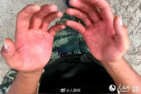 老茧，军人的特殊印记图片