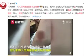 痒痒痒！6个小伙伴一起吸猫，结果都“中招”~宠物医生：吸猫撸猫小心斑秃喵→图片