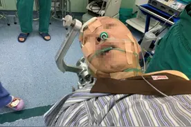 67岁的他脑子里肿瘤在侵蚀！术中唤醒，“清醒”状态下进行脑内肿瘤切除术图片