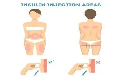 鑳板矝绱犲埗鍓傜殑鍒嗙被鍜屼娇鐢ㄤ腑鐨勫父璇嗭紝浣犵煡閬撳悧锛? onerror=