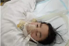 一场感冒让16岁少女呼吸衰竭，重度脊柱侧弯的她来深求医获救图片