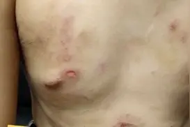 东莞8岁男童多次遭父亲虐打，全身赤裸离家，多处受伤图片