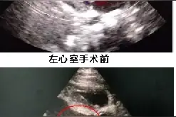 产检查出胎儿畸形，“流”还是“留”？专家建议家长得到权威答复后再做决定图片