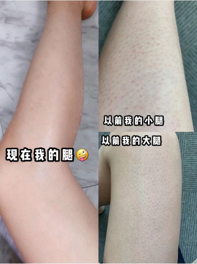 新生儿抹身体乳好还是精油好