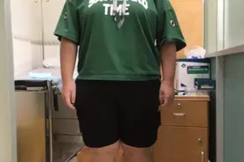 东莞15岁多毛女孩经治疗后，不足一月瘦18斤，还变开朗了图片