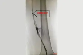 连坐10小时，20岁返校大学生腿肿如象！警惕隐形杀手“经济舱综合征”图片
