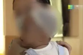 宝宝不慎坠床！家长的一个错误动作，差点要了孩子的命……图片