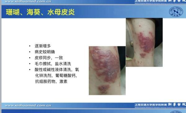 最长国庆长假即将到来，准备带娃去野外撒欢吗？这份防虫攻略请收好