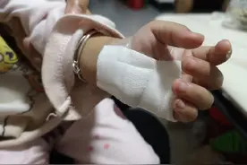 南宁2岁女孩遭电梯夹伤手鲜血直流，原来电梯也有感应“盲区”图片