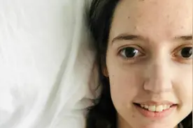 英国女子对所有食物和酒精过敏 两年内瘦31公斤图片