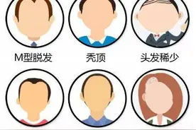 有件事，就挺“秃然”的…… | 睡前聊一会儿图片