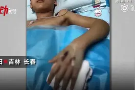 13岁男孩被网购"宠物"咬进ICU！妈妈懊悔：是我没管好图片
