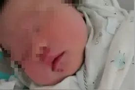 事发大连龙王塘一小区，出生仅11天的婴儿，多处被老鼠咬伤图片