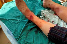 狗咬伤人，养狗主人却翻脸不认，法官开出司法“罚单”图片