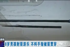 疼！露营地内一8岁男孩玩射箭游戏，不料手指被箭贯穿图片