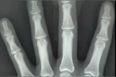 长沙一伴郎接亲怕挨打，着急逃跑被婚车门夹断手指图片