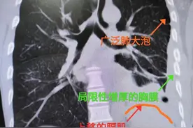 男子喝一箱多啤酒强忍不吐 结果食管破裂险丧命图片