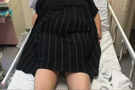 318斤孕妈产子，手术床躺不下！诞下10斤多大胖仔，镇江医护用实力守护母子平安图片