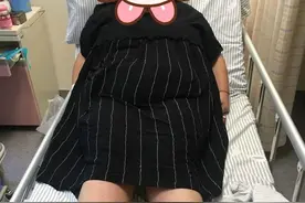 318斤孕妈产子，手术床躺不下！诞下10斤多大胖仔图片