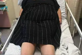 镇江318斤孕妈产子 诞下10斤多大胖仔，医护拼得母子平安图片