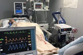 东莞这些医院有ECMO！被神化的利器背后，考量医院综合实力！图片
