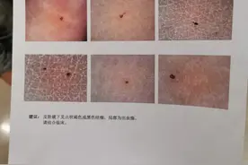 又有幼儿被老师针扎？警方介入调查，涉事幼儿园已关停图片