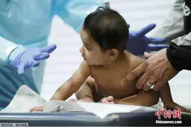 国际最新研究：婴儿感染新冠病毒大多因环境暴露亦有垂直传播图片