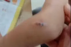 7岁男童因写作业被继母暴打，亲妈报警，父亲：她不是对孩子不好图片