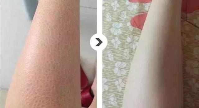 什么身体乳抹在身上会发热