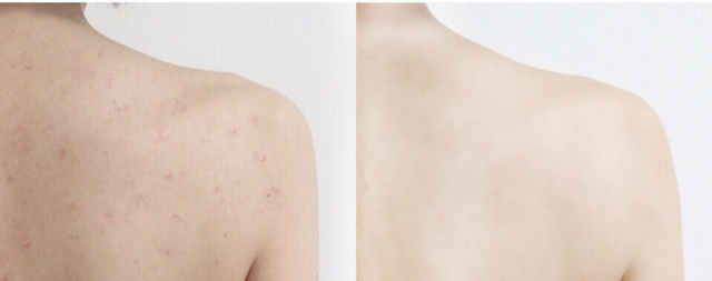 什么身体乳抹在身上会发热