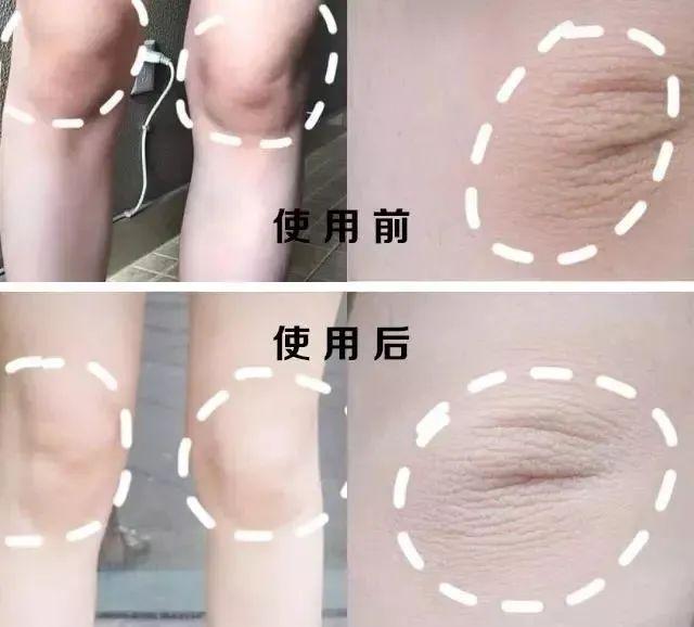 什么身体乳抹在身上会发热